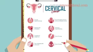 What are the Symptoms of Cervical Cancer