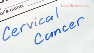 Whats Cervical Cancer