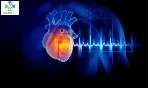Myocardial Infarction Heart Attack